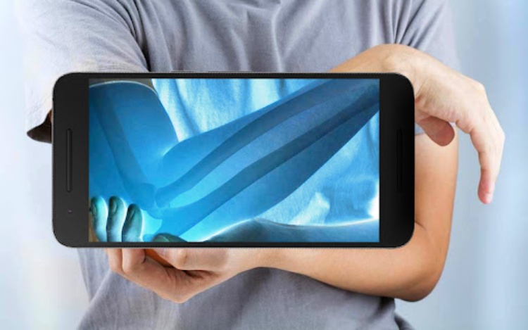 XRAY Scanner Xray Doctor Game