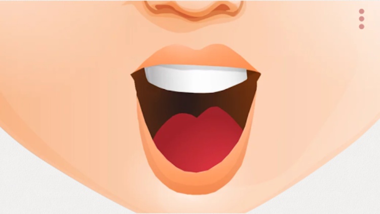 Reach Speech: Speech therapy