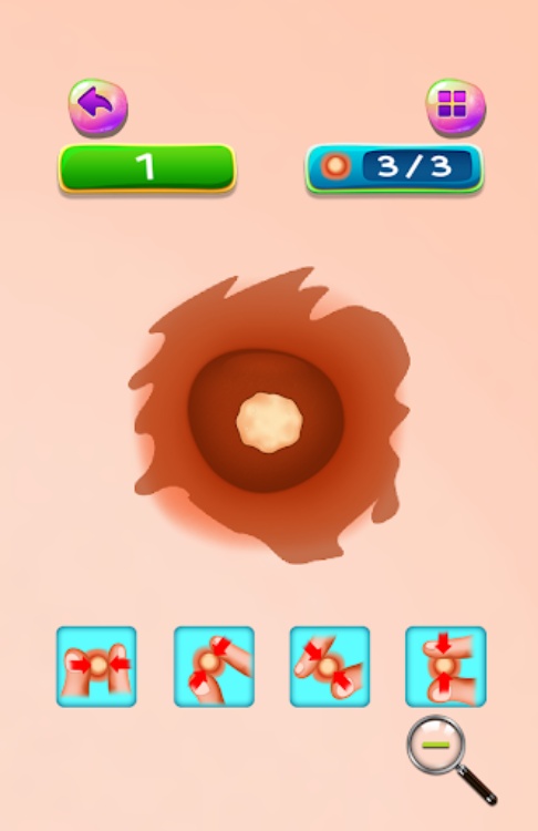 Pimples and Blackheads Removal